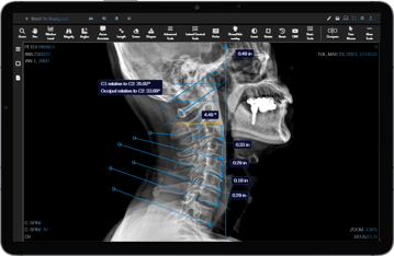 LateralCervical.a5e43856763a3a97bda7 (1)